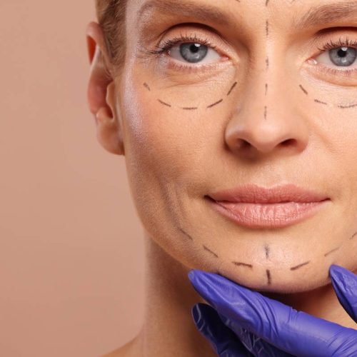 Chirurgo plastico per il trattamento delle rughe a Roma Parioli