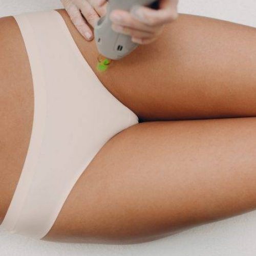 Epilazione laser diodo a Bologna Corticella