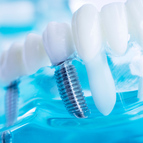DENTISTA A VALLO DELLA LUCANIA