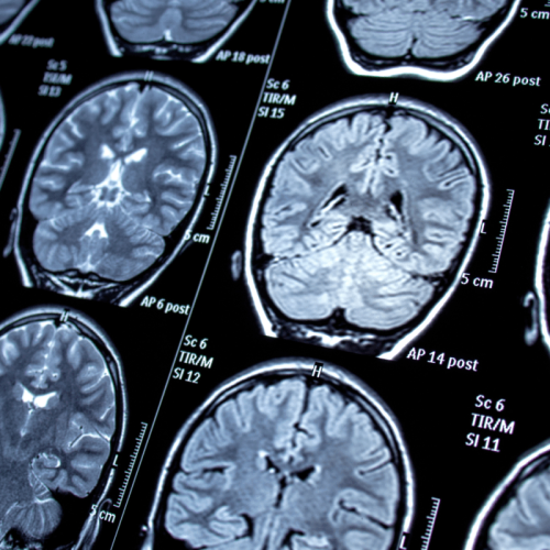Neurologo a Palermo