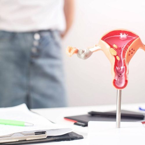 Trattamento menopausa a Potenza