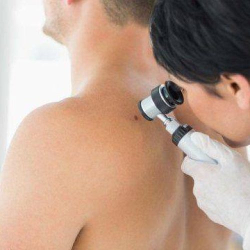 Dermatologo a Cosenza