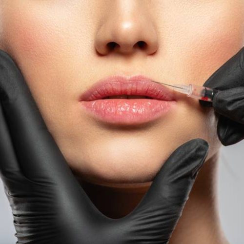 Epilazione laser a Figline Valdarno