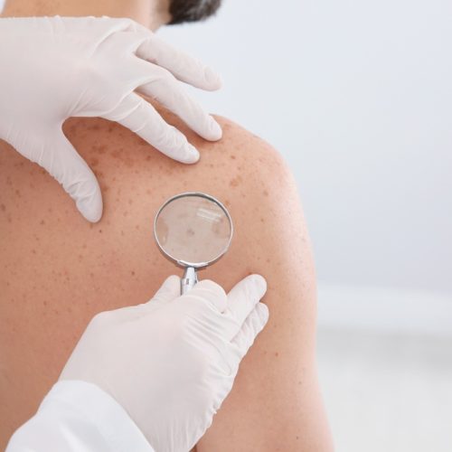 Visite dermatologiche a Legnago