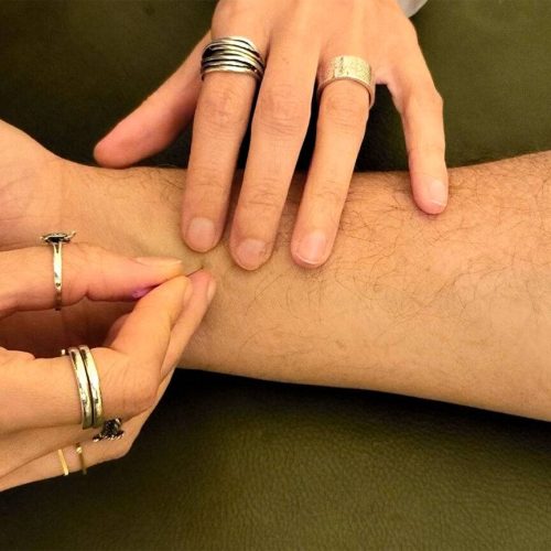 Trattamenti di agopuntura e fitoterapia a Bari